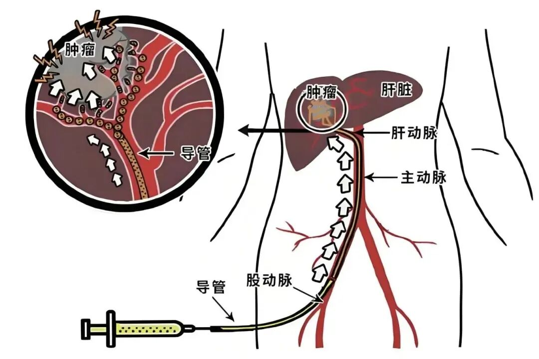 配图5